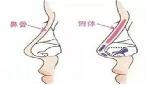 做完手术以后