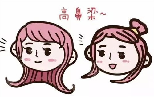 无假体隆鼻术后一个月