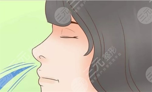 无假体隆鼻术后2个月