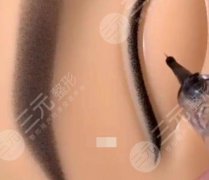 美瞳线一到七天恢复过程图分享,“懒癌”求美者的福音,素颜也能打 美瞳线一到七天恢复过程图分享,“懒癌”求美者的福音,素颜也能打