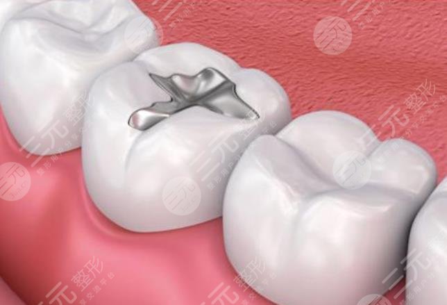 补牙