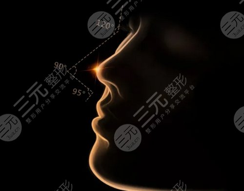 国内隆鼻