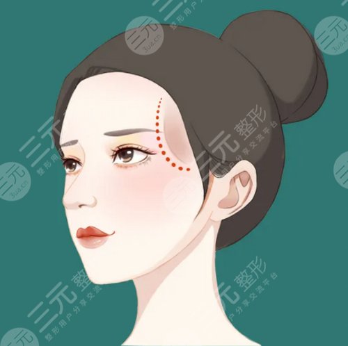 脂肪填眼窝一年后图片