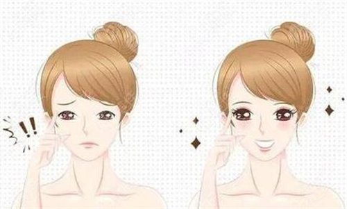 c+近视