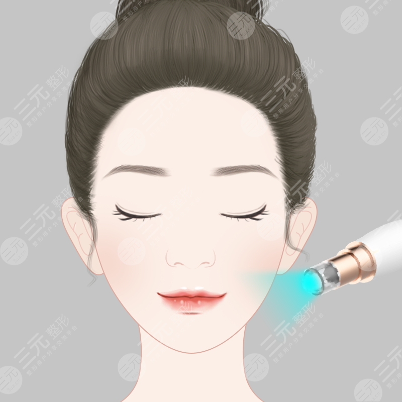 广州美莱打涂抹式水光补水果怎么样?可以保持多久?