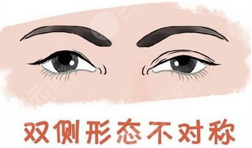 什么是双眼皮修复手术？