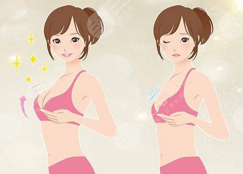 韩式隆胸手术原理是什么