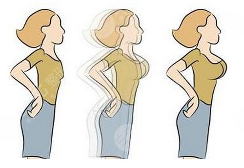 少女如何选择丰胸方法