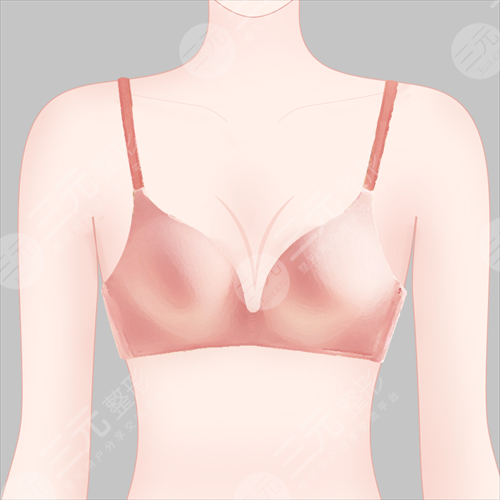 乳房下垂矫正手术