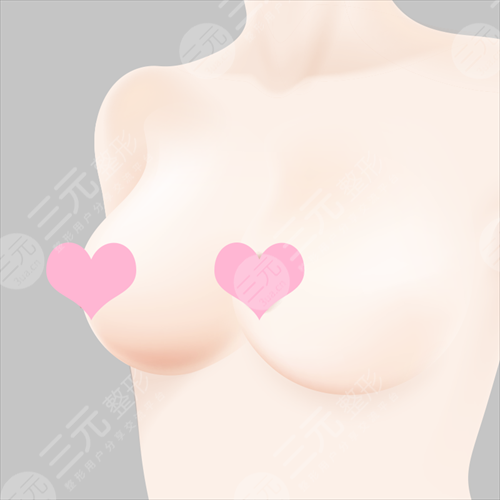乳头缩小手术副作用大吗?
