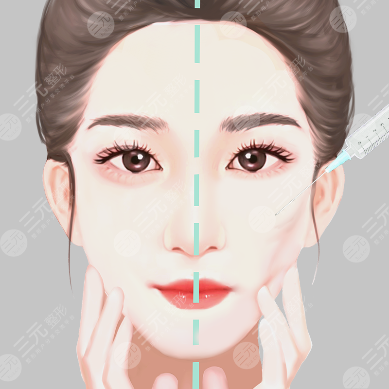 成都玻尿酸丰面颊果怎么样?玻尿酸丰面颊果好不好?