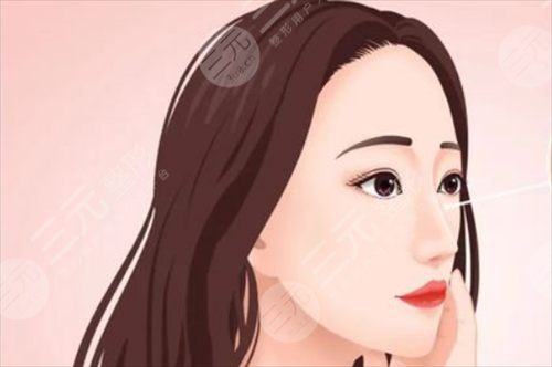 玻尿酸隆鼻果