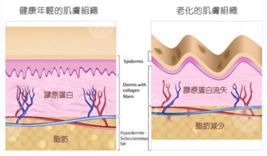 注射除皱降低风险吗