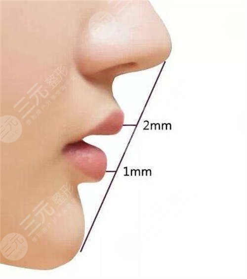 驼峰鼻矫正术价格