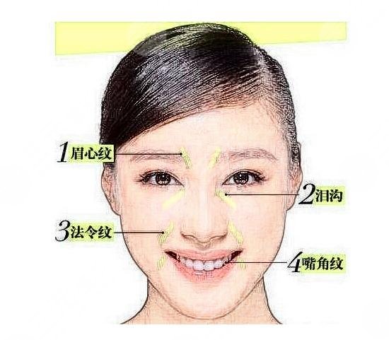 郑州注射瑞蓝玻尿酸多少钱