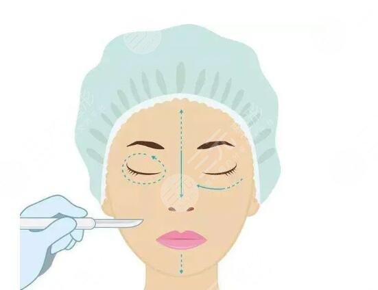 郑州注射瑞蓝玻尿酸多少钱