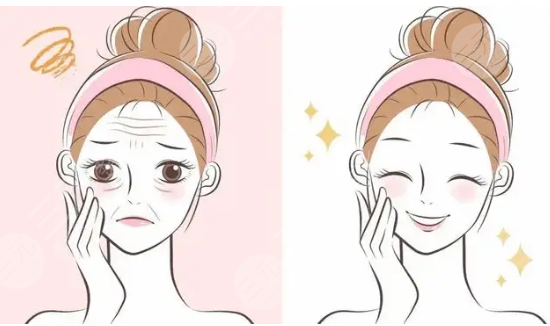 ****注射除皱术降低风险吗