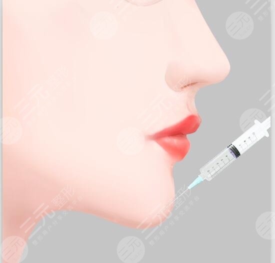 玻尿酸丰下巴价格多少