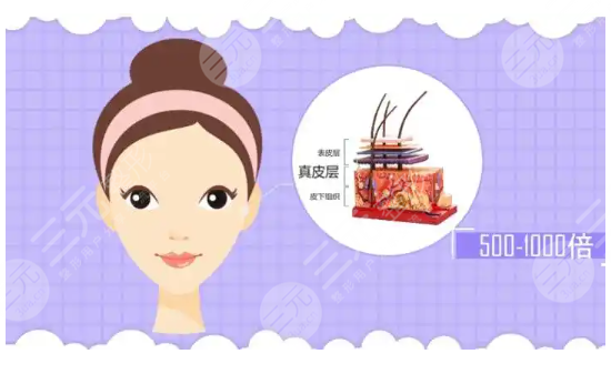 玻尿酸填泪沟经验