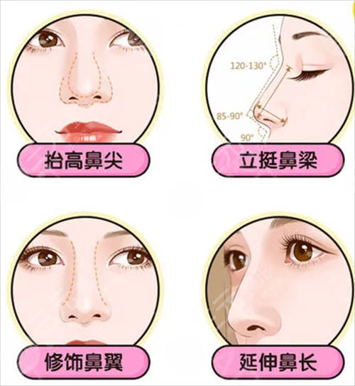 骨膜下隆鼻美容靠谱吗?戳进来了解骨膜下隆鼻的真实果~