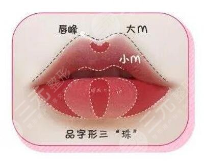 玻尿酸丰唇珠图片