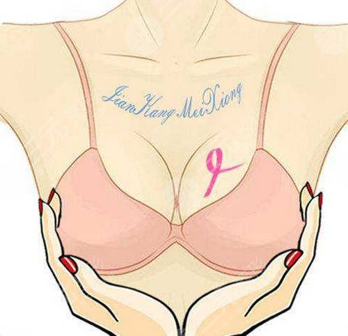 切除乳房外上1/4的中厚皮片,然后提紧缝合,上提固定,以矫正乳房的松垂