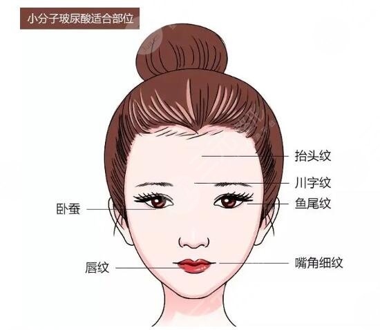 嗨体水光