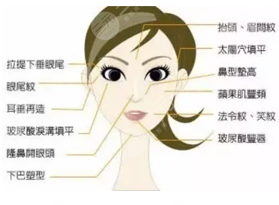 玻尿酸填充