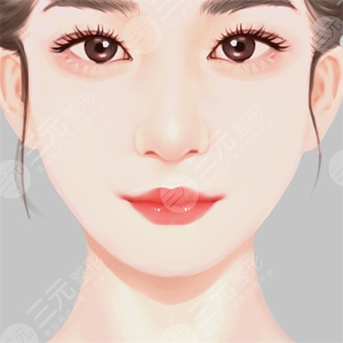 吸脂,瘦脸,恢复