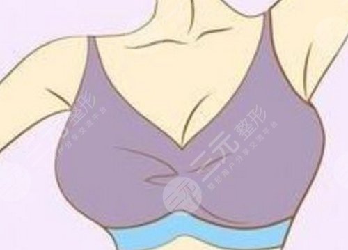 乳房下垂矫正手术后会再松弛吗