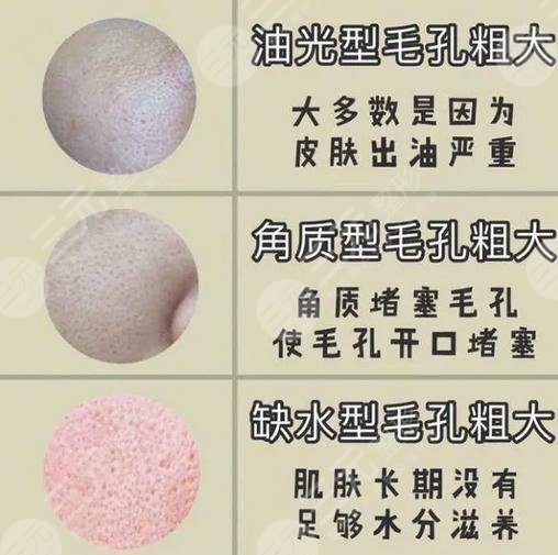 什么办法可以让毛孔缩小