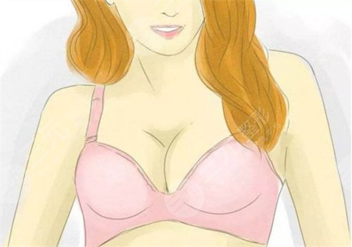 轻度乳房下垂应该怎样选择矫正方法？