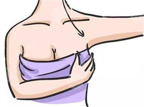 乳房为什么会下垂？乳房下垂的原因及矫正方法