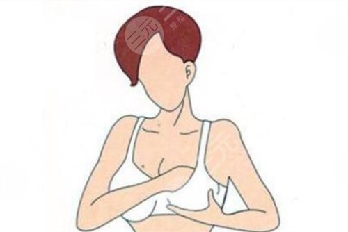胸部整形无缝丰胸有哪些优势?