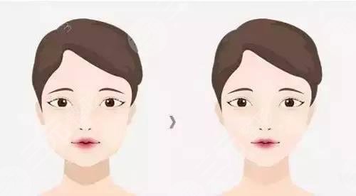 长期打B****会有副作用产生吗