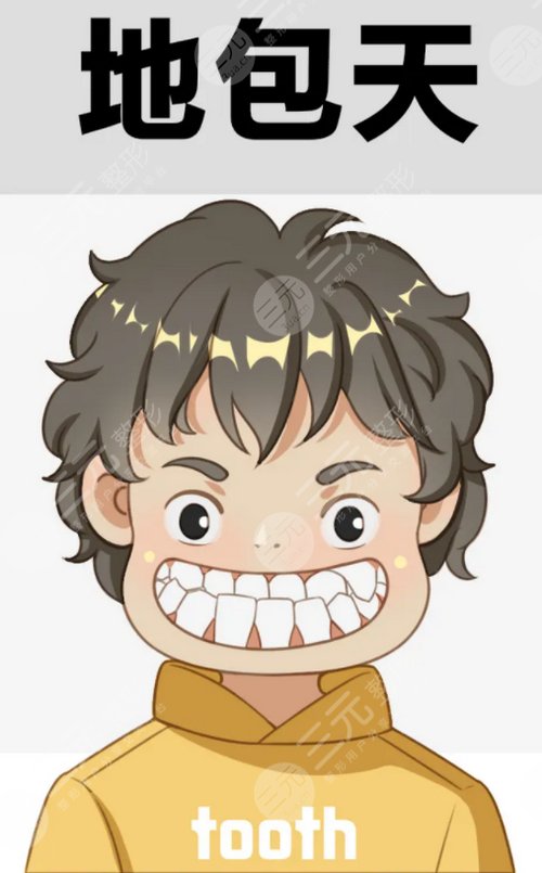 地包天有哪些矫正方法