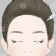 <b>玻尿酸丰太阳穴</b>