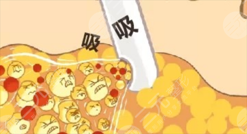 4d火凤凰溶脂果怎么样？可靠性如何？多久出果？