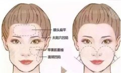面部整形后禁忌