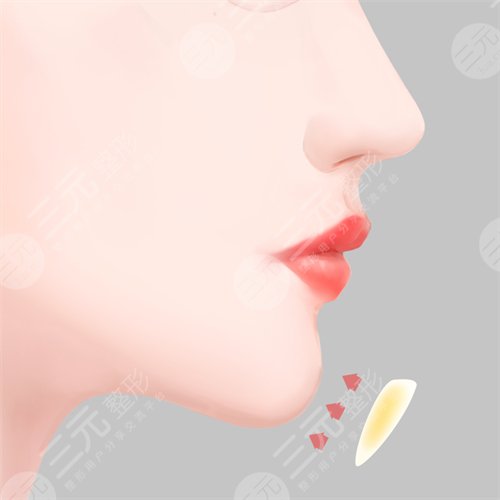 怎么样瘦双下巴