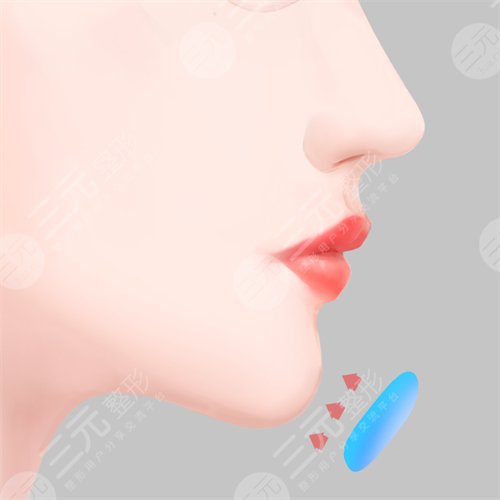 怎么样瘦双下巴