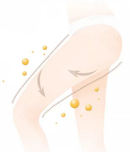 怎样减肚子上的赘肉：腰腹吸脂1招搞定，超全科普来看！