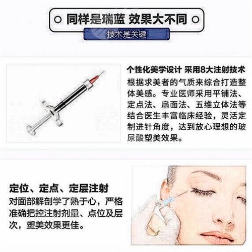 瑞兰2号价格多少钱一支 瑞兰2号价格多少钱一针