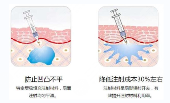 玻尿酸有什么用