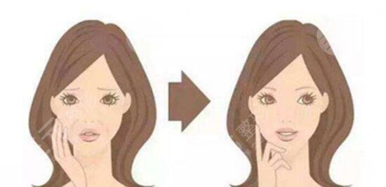 怎样快速去除鱼尾纹