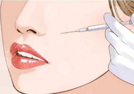 美白祛斑填充皱纹的成好吗