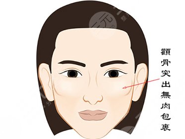 【颧骨高】颧骨高杀人不用刀 颧骨比较高怎么办