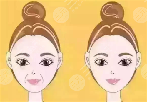 面部填充果怎么样?试试不就知道了