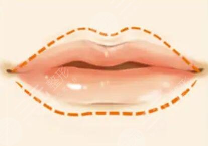 纹唇一到七天恢复图片真实过程：好唇色衬托好气色！早上出门节约几分钟！