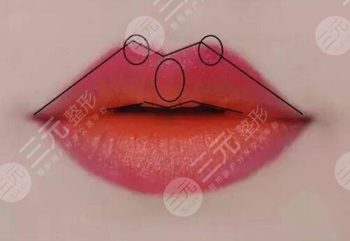 纹唇术后注意事项